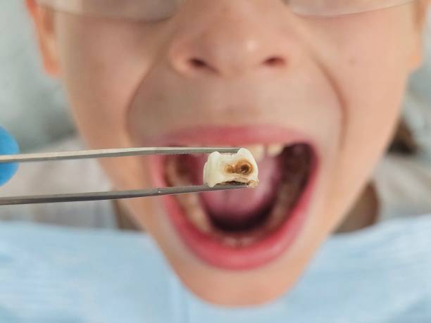 Best Dentist for Dental Trauma  in Sweet Home, OR